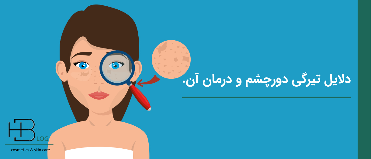 چرا سیاهی دور چشم به وجود می‌آید، با 7 راه حل آن آشنا شوید